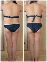 リノ(Lino)/【30代女性】全身痩身4回の変化
