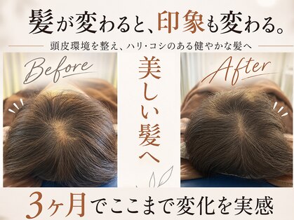 ハリング(HARIING)の写真