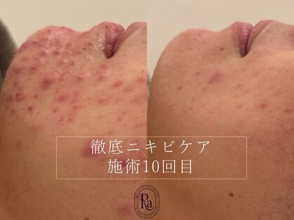 アールエーサロン 恵比寿 広尾(Ra salon)の写真