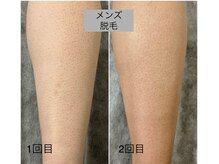 アケルビューティースタジオ(acer beautystudio)/