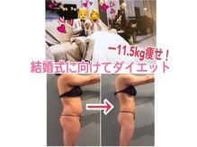 ボディエステティック アクアオーラ 高岡店/結婚が決まり本格的にダイエット