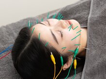 オプト鍼灸整体院 たまプラーザ本院(opt.鍼灸整体院)/美容鍼