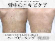 フェイシャルヴィム(FACIAL VIM)の雰囲気（初回以降も同価格で通いやすい◎イベント前はお早めのご予約を◎）