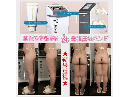 リラエス(Rela S)の写真