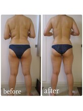 加圧ビューティーサロン スタイル エム(beauty salon style M)/30代/加圧×パワーツリー120分