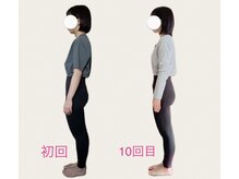 フォーシー(4C)/Before/After