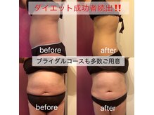 リンパケアサロン ジュビル(Jubil)