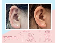 丸太町骨盤整骨院 鍼灸院/耳つぼジュエリー