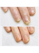 ティアラ(Tiara)/