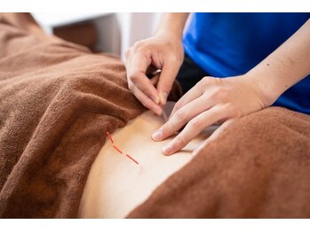 鍼灸ハリカラ/腰のつらさを改善したい◎