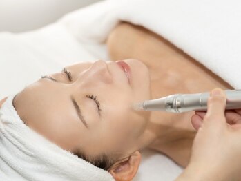 アラン(Aran)の写真/NEW【毛穴レス艶肌】ダウンタイムなしの集中ケア☆ソフトダーマ×美容液導入で自信の持てる素肌を叶える♪