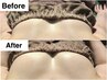 【口コミ限定☆左右差/下垂】大きさ・形を整え左右差0のお胸に!/¥30800→