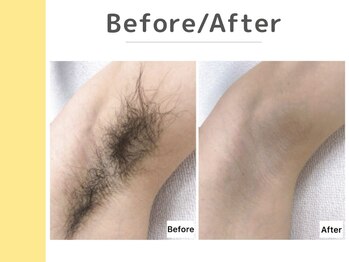 キングスサロン 神戸ハーバーランド店/〈 Before / After 〉