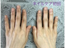 桃の木 吉祥寺店/自爪育成ネイルケア★初回施術後
