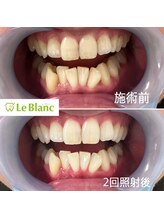 ルブラン 奈良店(Le Blanc)/フリーパスコース スタート！