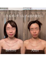 アイミーボーテ(Aime beaute)/《コルギ+デコルテ》