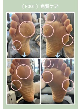 プティットスリール アイラッシュ 豊田店(Petit Sourire Eyelash)/【角質ケア】スクラブ＋パック*