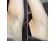 シャンティ(Shanti)の写真