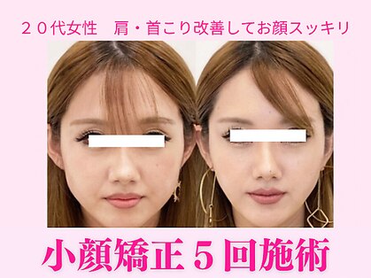 ワンモア 新町店(1+MORE)の写真