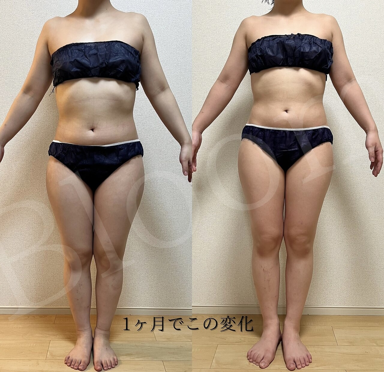 YOSA激安！早い者勝ちヨサ☆バーニングハーブ10袋15400円→11699円 Amazon.co.jp: YOSA ヨサ バーニングハーブ 50個 : 食品・飲料・お酒