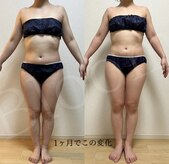 ヨサパーク ブルーム(YOSA PARK Bloom)