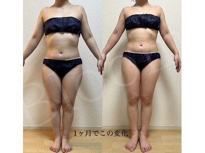 ヨサパーク ブルーム(YOSA PARK Bloom)の写真