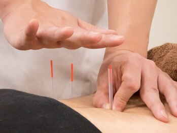 西葛西駅前あさひろ鍼灸整骨院の写真/【ベテラン鍼灸師在籍】肩こり・腰痛にお悩みの方必見!あなた専用のオーダーメイド施術で不調を根本改善♪