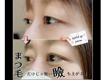 プリティアイ(pretty eye)