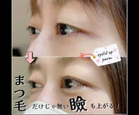 プリティアイ(pretty eye)