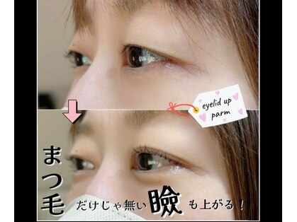 プリティアイ(pretty eye)の写真