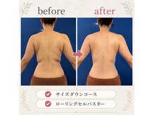 アンプリール(emplir)の雰囲気（結果重視のサイズダウンコースは、サロンケア＆サポート付き）