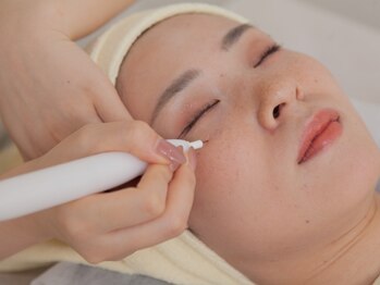 TD 一宮店の写真/【気になるシミに直接アプローチ♪】3000円～2回目以降も同価格！
