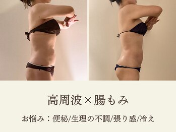 ミオン(美温)/腸もみ&よもぎ蒸しで痩せる!