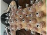 【カッピング付きプレミアム整体】カッピング+首・肩こり・腰痛・60分￥5480