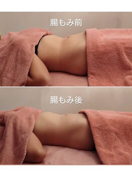 ソワンテラピー(Soin Therapy)/腸もみ+骨盤調整 1回