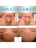 ★40代肌ケア★小顔リガメントケアorハイパ-ナイフEX小顔コルギ+毛穴縮小90分