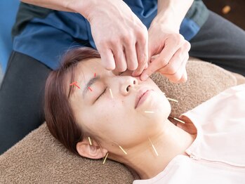 叶(kanae)/美容鍼の施術（顔）