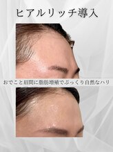 サロン ド ナース ユー ソナ(salon de nurse U.sona)/ヒアルロン酸より自然に造形