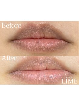 美白ケアをしたい