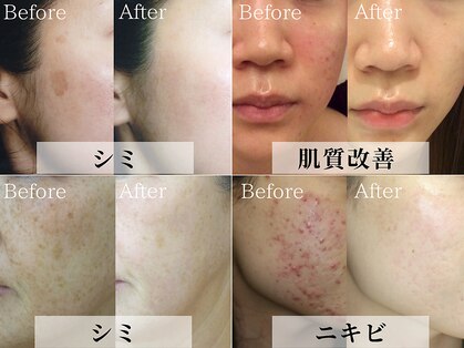 ベルタ(BELTA)の写真