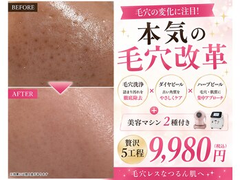 フェザード フレンズ 松山店の写真/小顔を目指すケアでリフトアップ!気になるほうれい線やたるみも、フェイスラインを整え美しく♪