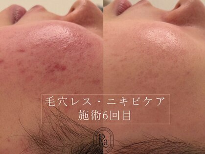 アールエーサロン 恵比寿 広尾(Ra salon)の写真