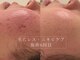 アールエーサロン 恵比寿 広尾(Ra salon)の写真