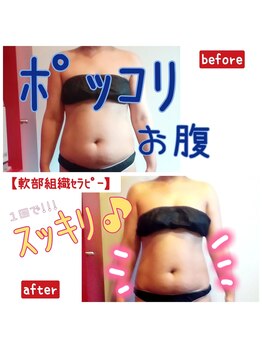 ビューティサロン キヨの部屋(beauty salon)/軟部組織セラピー【1回 】