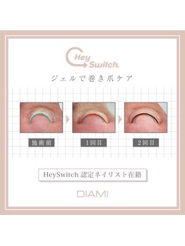 インプルーヴ(improve)/