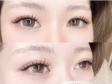 リリアン(Relien)/LEDバインドロック 100束