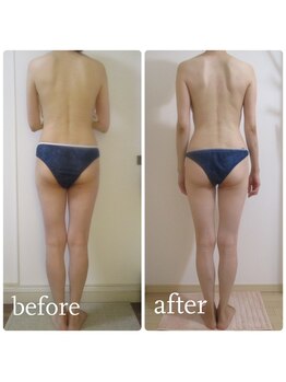 加圧ビューティーサロン スタイル エム(beauty salon style M)/40代/ピラティス・ヨガ