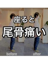 カワル整体 上通り院/座ると尾骨痛い人