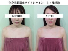 サンビ(SANBI)/肌くすみ撃退★