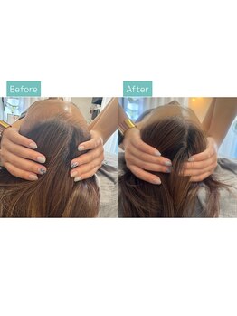 ザ レディービー(The Lady B)/バザルトヘッドスパ